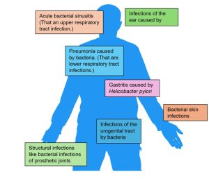 use of Amoxicillin infographic by MVS Pharma GmbH