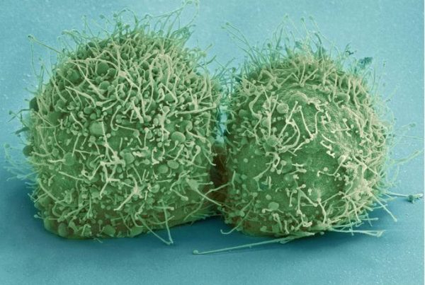 picture of green cells used in a german article about Wirkmechanismus von Amoxicillin